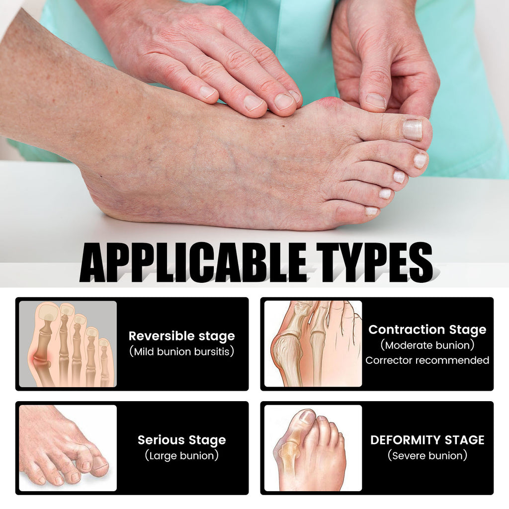 Bunion Relief Socks – Foot Health & Toe Alignment Support