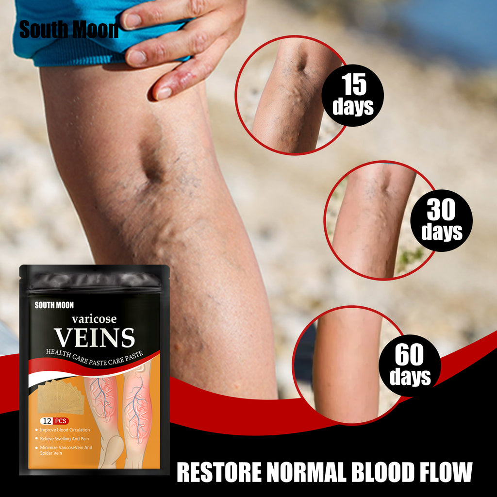 Varicose Vein Relief Patch – Topical Leg Circulation Support