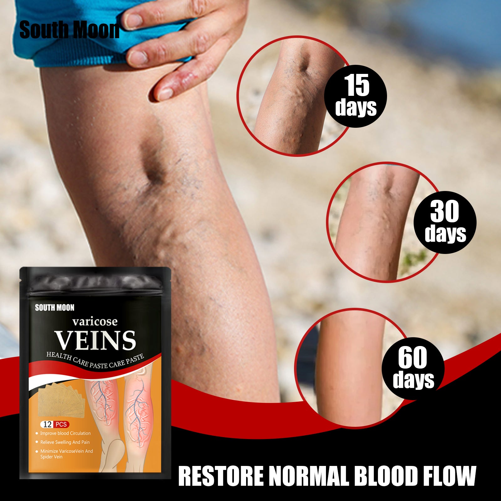 Varicose Vein Relief Patch – Topical Leg Circulation Support