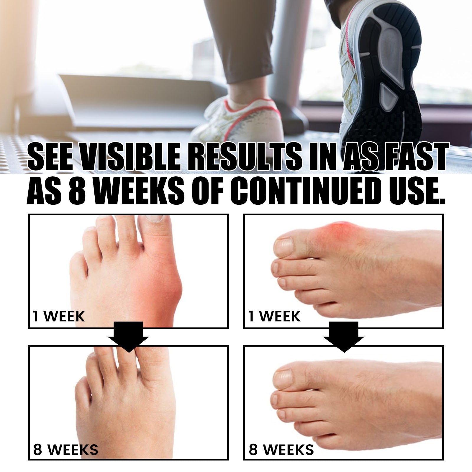 Bunion Relief Socks – Foot Health & Toe Alignment Support